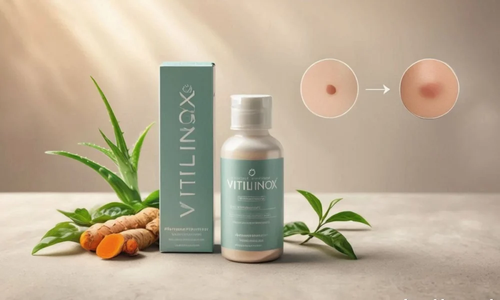 Vitilinox: The Complete Guide to the Natural Vitiligo Skin Support Product