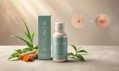 Vitilinox: The Complete Guide to the Natural Vitiligo Skin Support Product